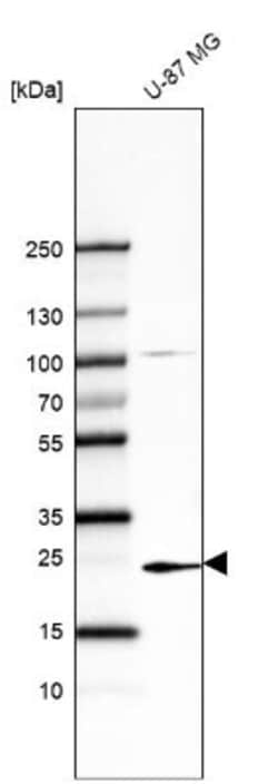 TREM1 Antibody (CL7111), Novus Biologicals TREM-1 Antibody; Unconjugated;